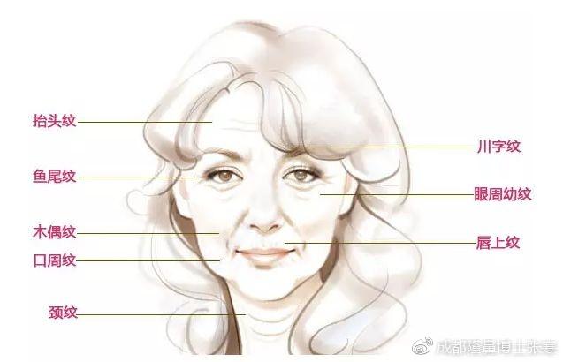 肉毒素的面部除皱方法