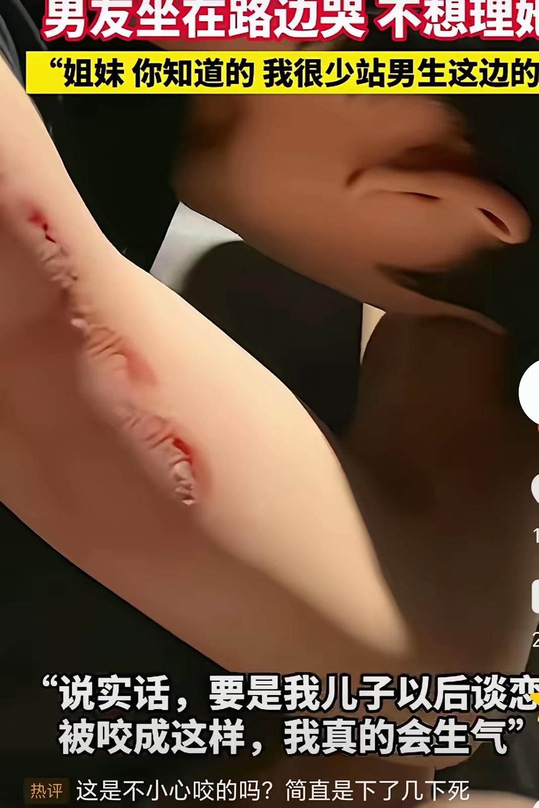 看到一个女孩把男友胳膊咬得鲜血直流，一口接一口，男友疼得直哆嗦，脸上泪水止不住地