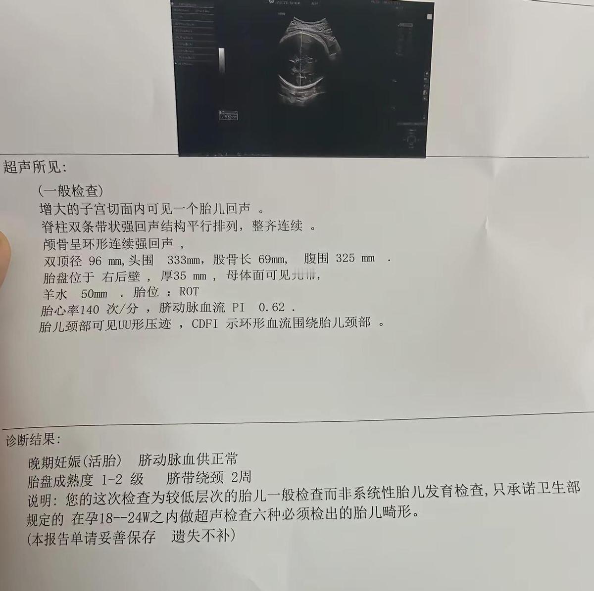 孕晚期心慌？正常。胎动数着，别瞎想。双顶径9.6，没超标，别被数字绑架。