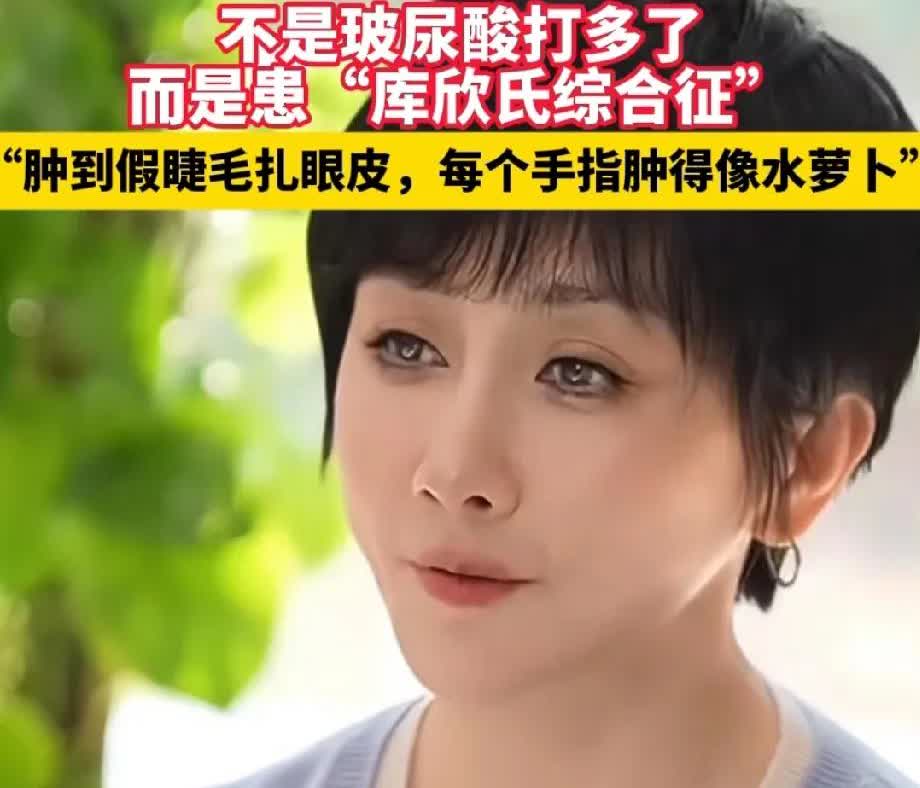 为什么很多女明星明明自己整过容，却打死也不承认。最近44岁的某不知名女明