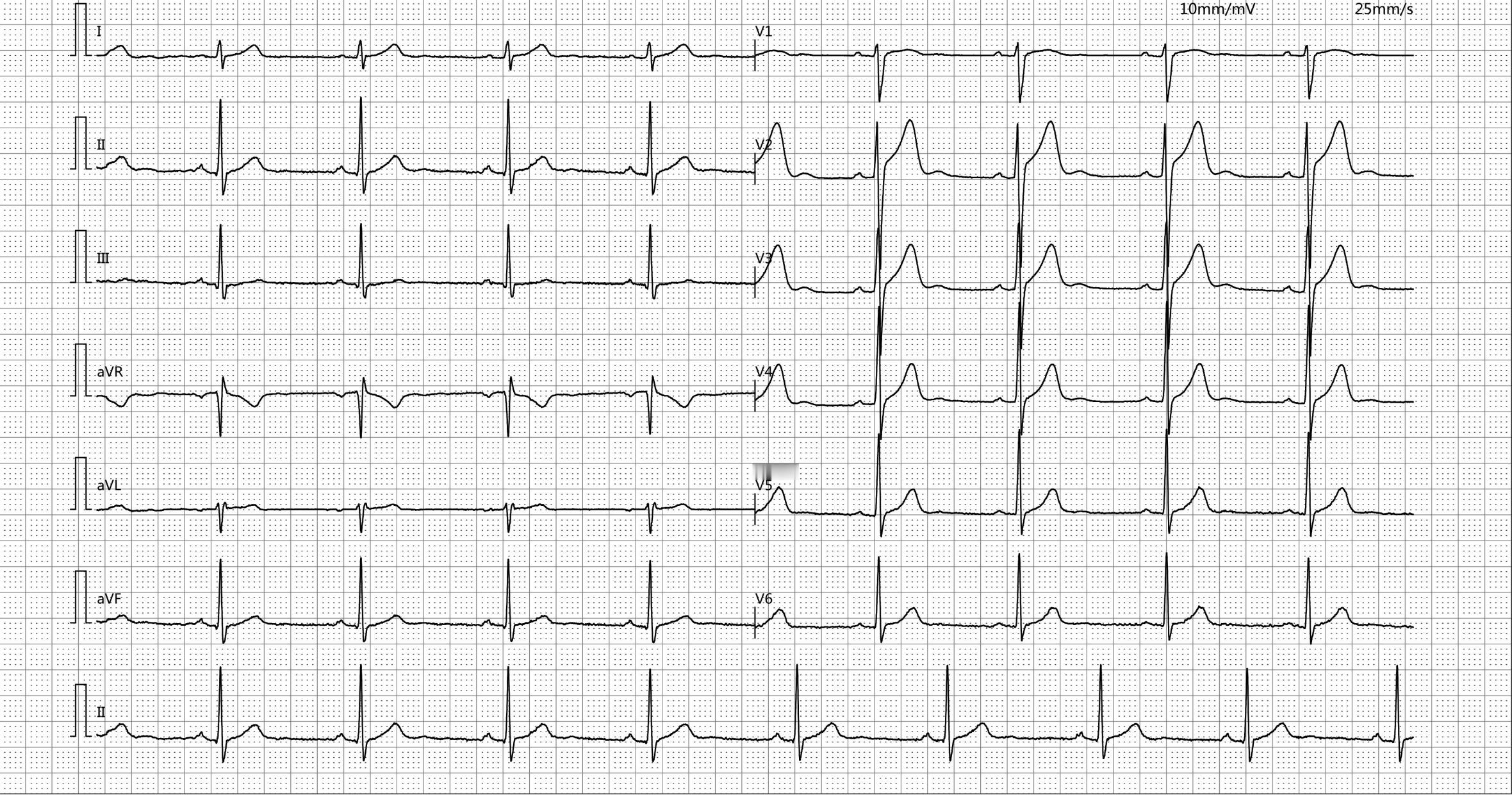 猜猜我的心率是多少：