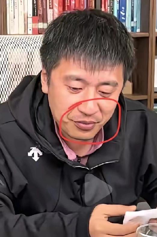 某博主在24年看到张老师的一次直播之后说:腾蛇入口，各方面要注意了。法令纹也叫寿