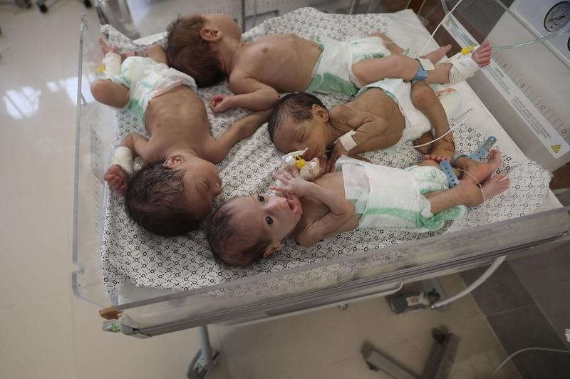 5月龄女婴心脏手术后离世，这事真让人揪心。女婴是早产儿，有心脏“房间隔缺损”，家