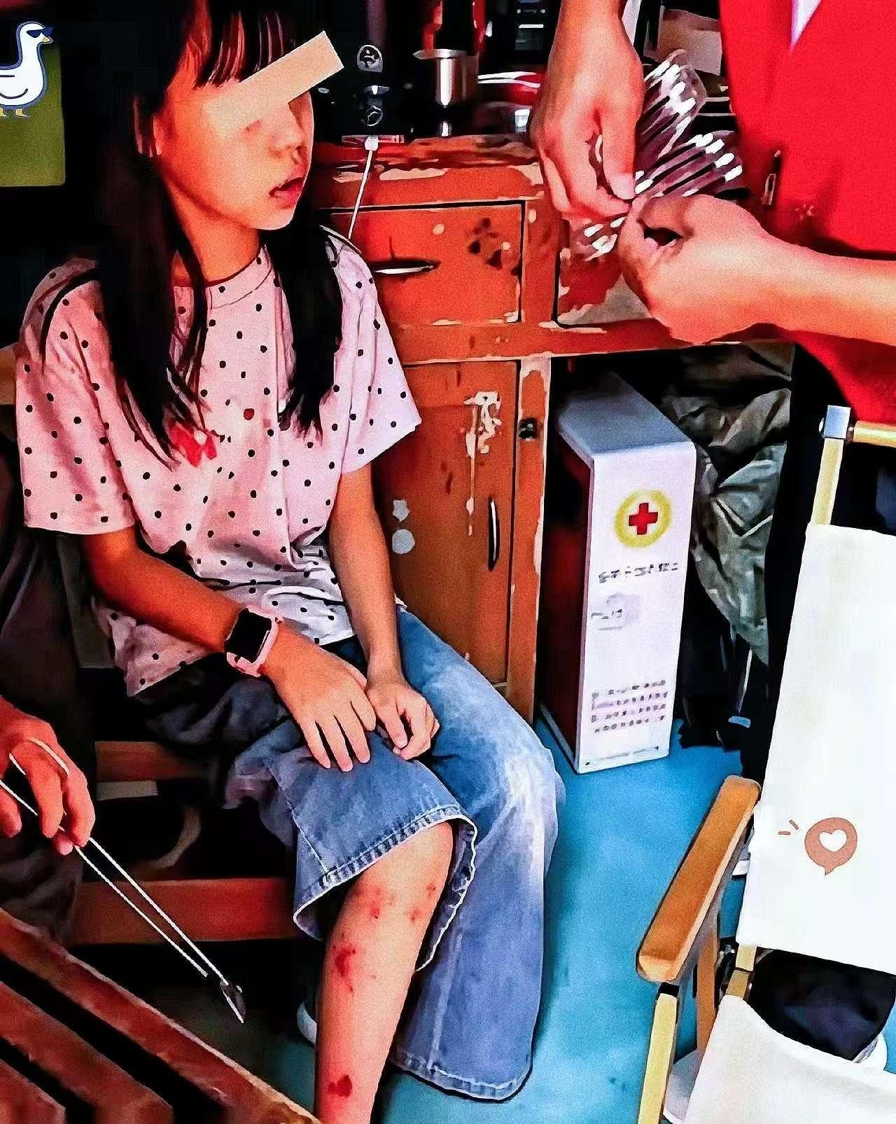 江西龟峰那桩荒唐事，真是越看越气！家长带孩子在景区游玩，孩子不小心磕破腿部流