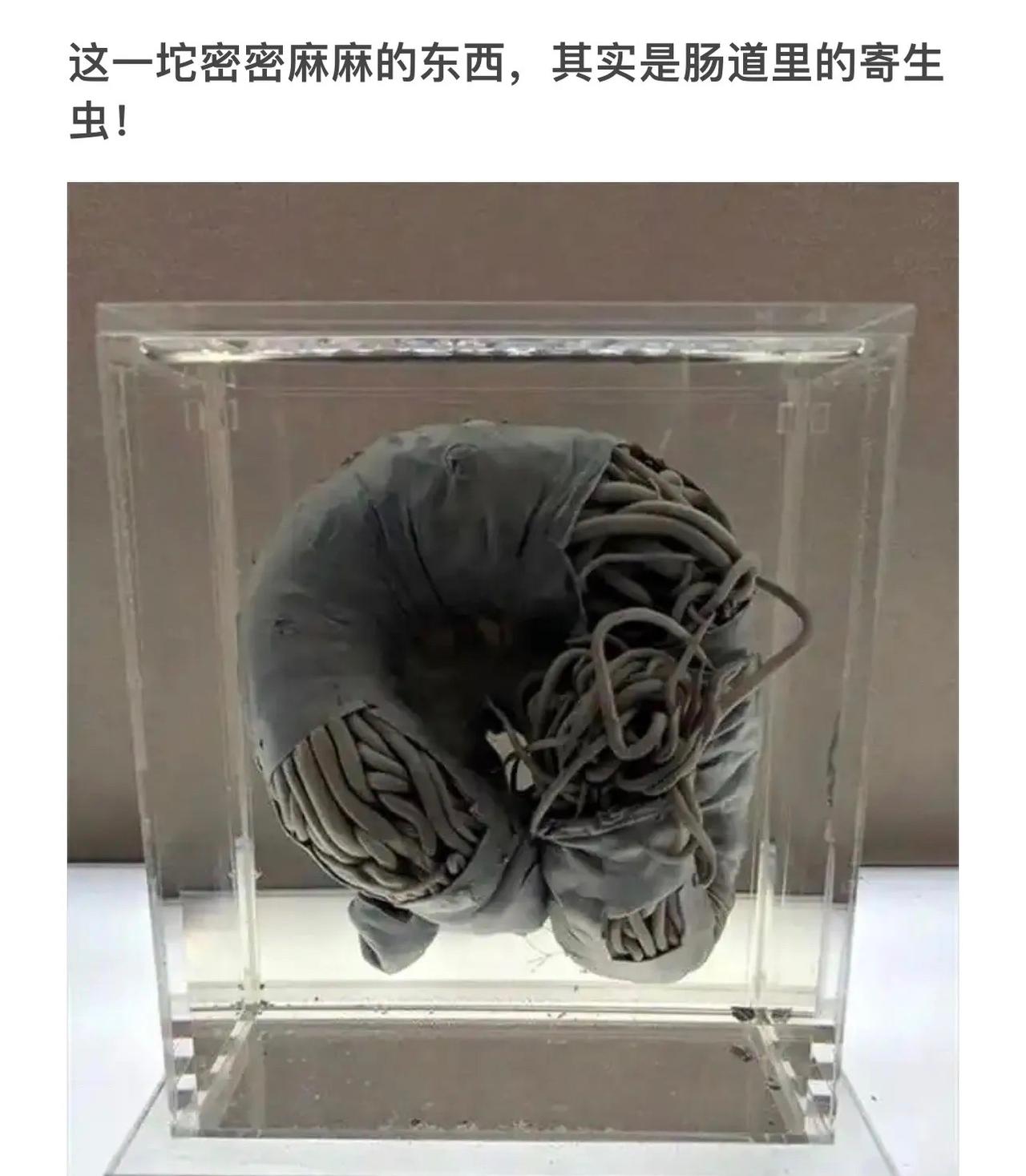 肠道里的寄生虫，你敢信？！😱🔍