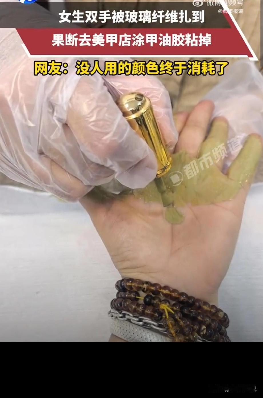 这是真聪明！5月13日报道浙江，一女生双手被玻璃纤维扎到，细刺细到肉眼看不见，可