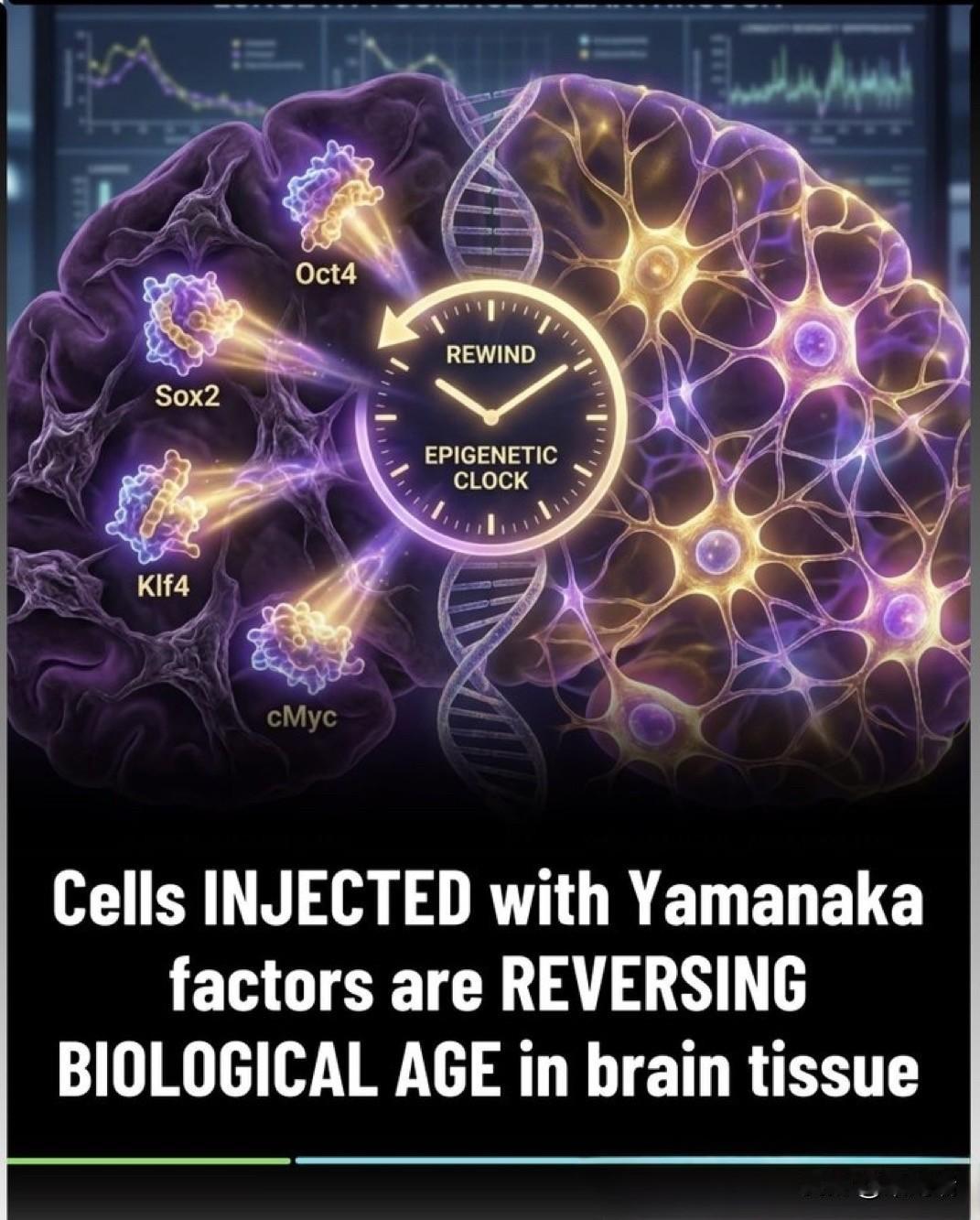 美国科学家们对衰老的脑细胞按下“重置”键……结果成功了！这听起来不可能——但