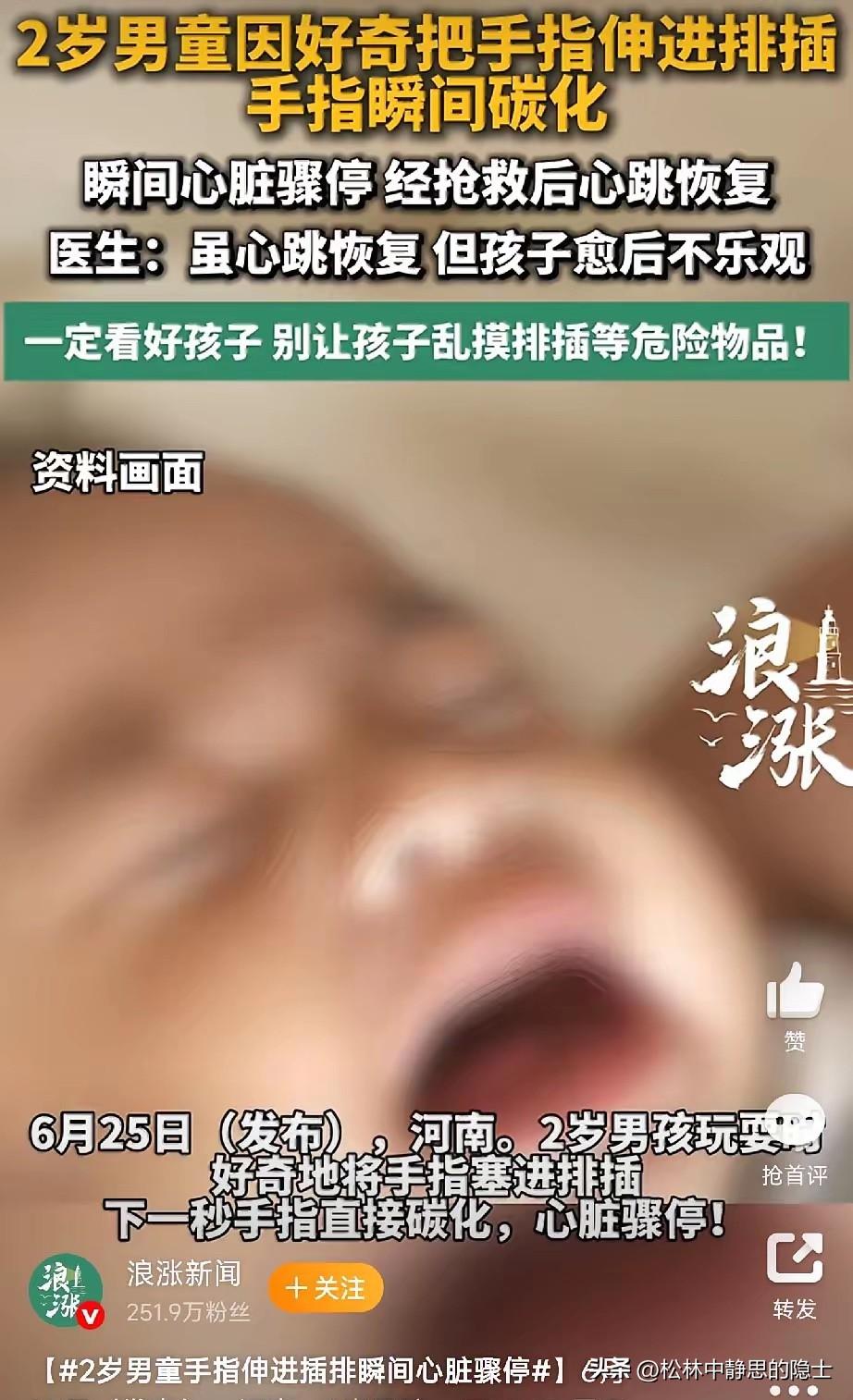 太痛心了。河南一名2岁的小男孩趁大人没留神，把手指头塞进了通电的排插插孔。就那么