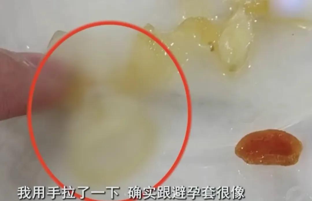 浙江诸暨，张先生一家人点外卖用餐，在酸辣土豆丝里面发现一块橡胶质地异物，咀嚼很久