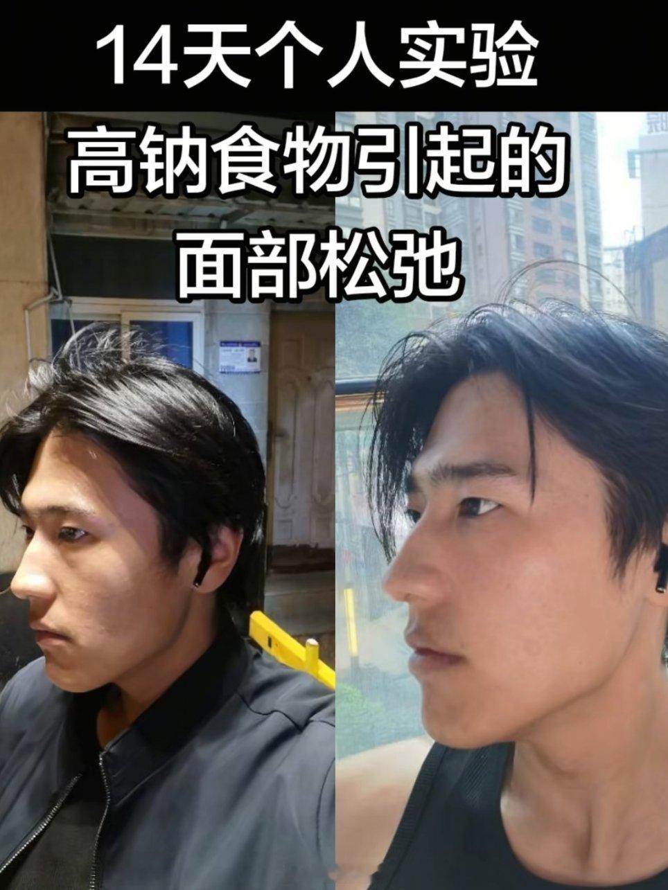 长期吃高钠食物真的会变丑​​​