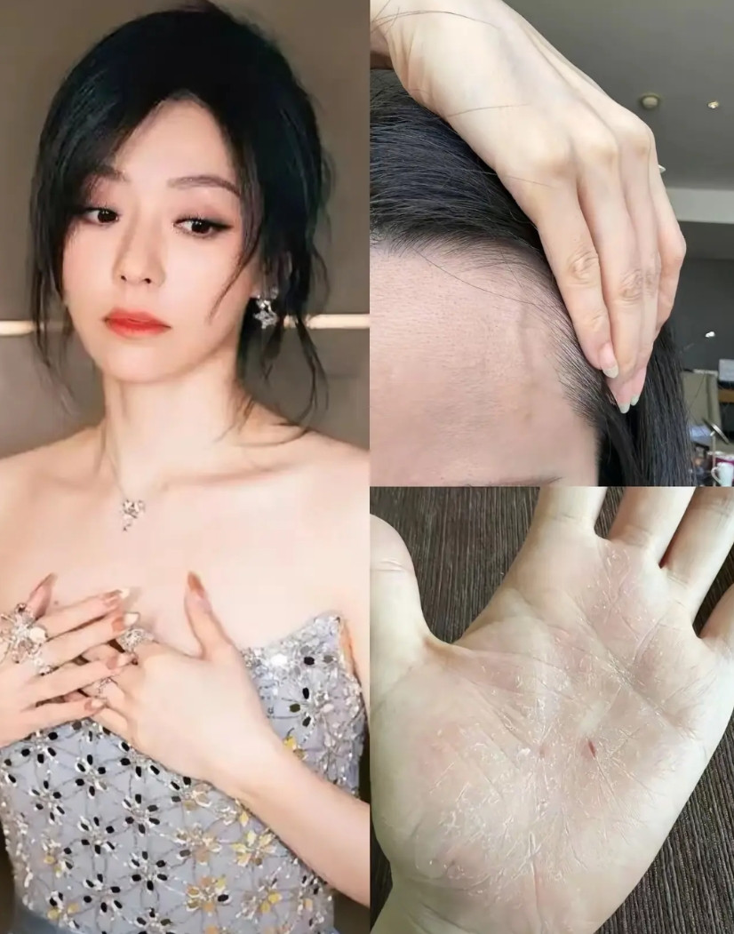 张靓颖后半辈子可能都不能吃辣了不是因为会影响她的歌声，实在是她体检报告显