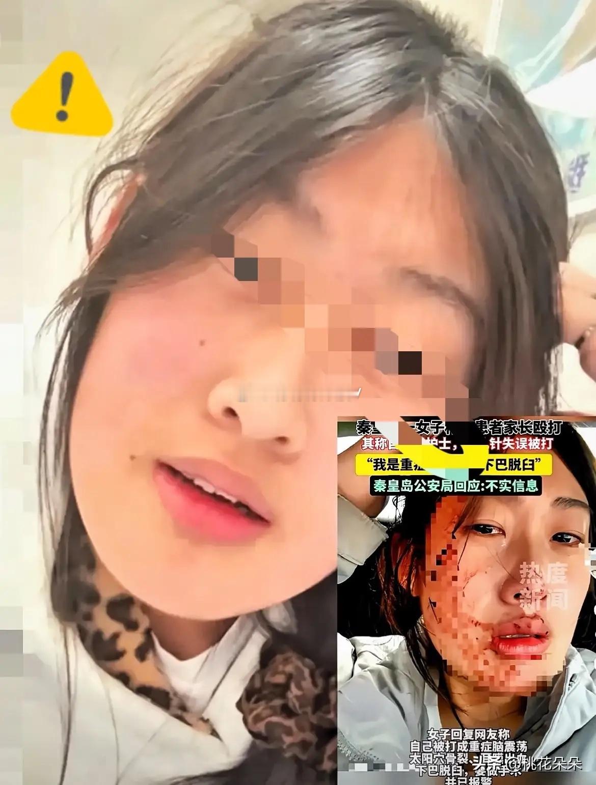 万万没想到护士被打的事居然反转了！秦皇岛市第一医院护士被打事件，发布视频的账号已