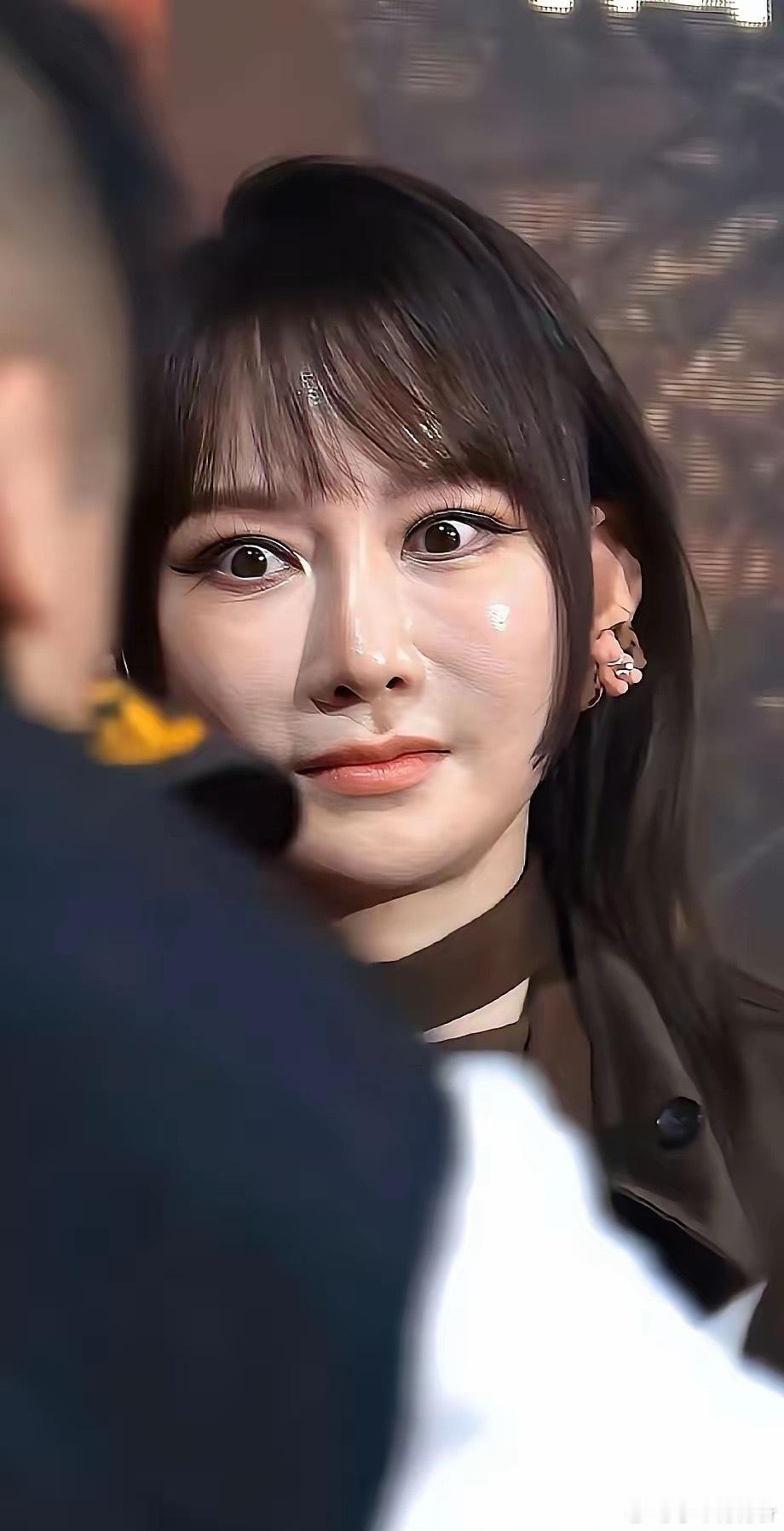 第一眼真没认出来，原来医美的尽头是假面到像个陌生人，让人不敢认，比起奇怪僵硬的假