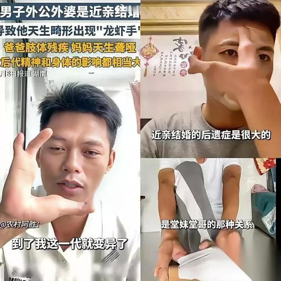 近亲结婚有多可怕？看完窒息湖南一90后男子太惨了！外公外婆是亲堂兄妹，妈妈天