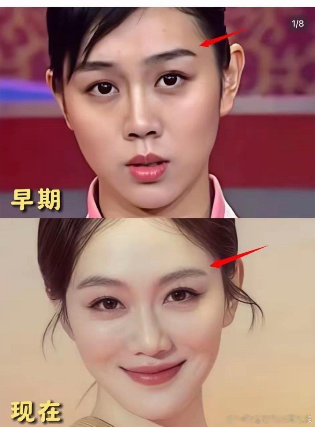 姜妍没有整之前真的不好看典型的东北大妞，所以，她一直不瘟不火！她现在的美感，不是