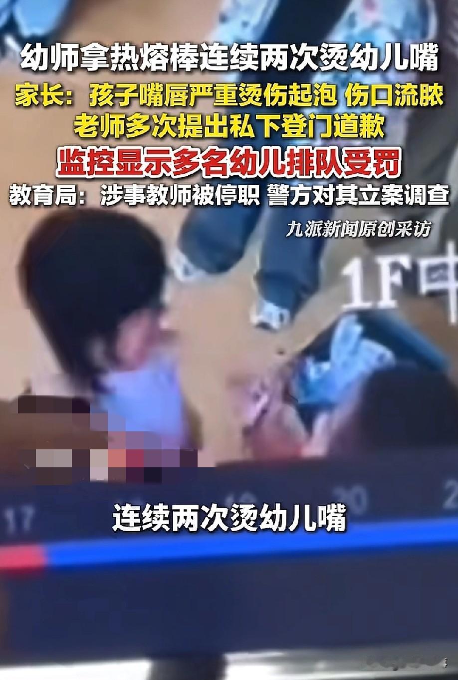 越细想越心惊，徐州那个拿电热棒烫小孩的老师，为啥偏偏选择烫嘴唇呢？而且还那么明显