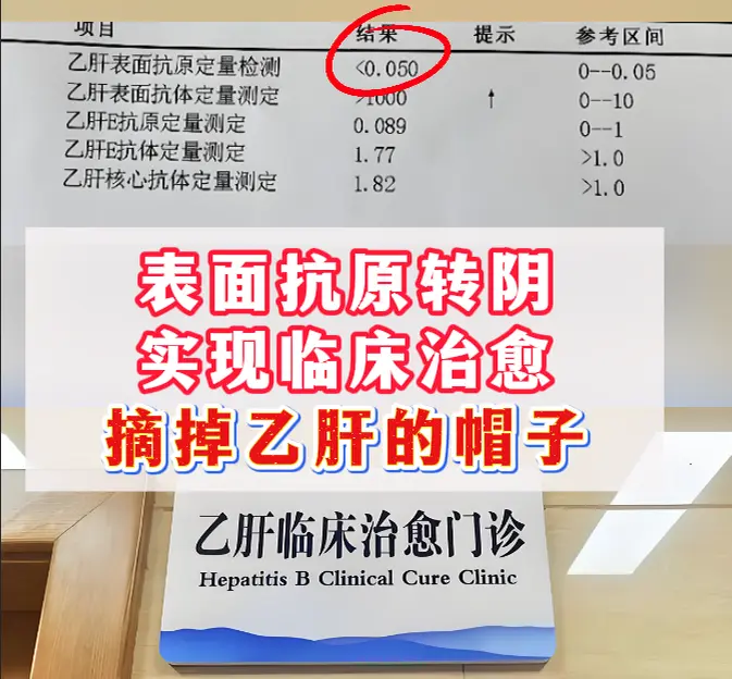 35 岁的李先生，乙肝小三阳多年，病毒持续阳性，一直担心肝硬化、肝癌。...