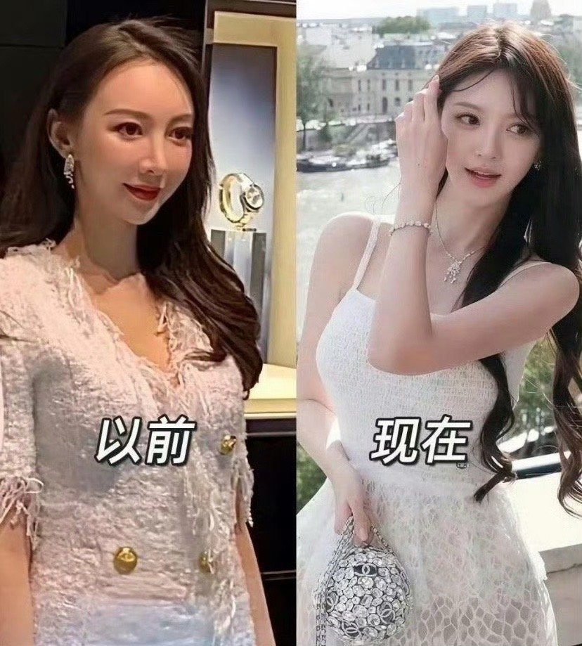 叶珂自曝一年变美花费叶珂以医美过来人身分劝女生别过度为医美花钱引共鸣，毕竟医美开