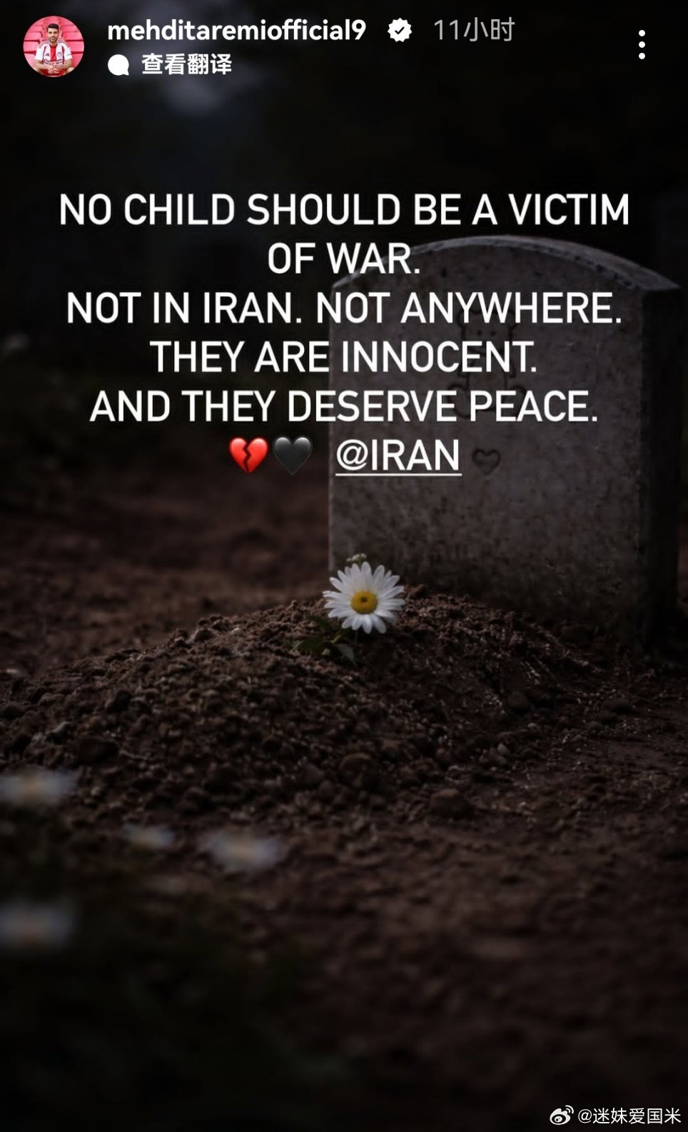 塔雷米快拍：任何孩子都不应该成为战争的受害者。不只是在伊朗，任何地方都不应该。他