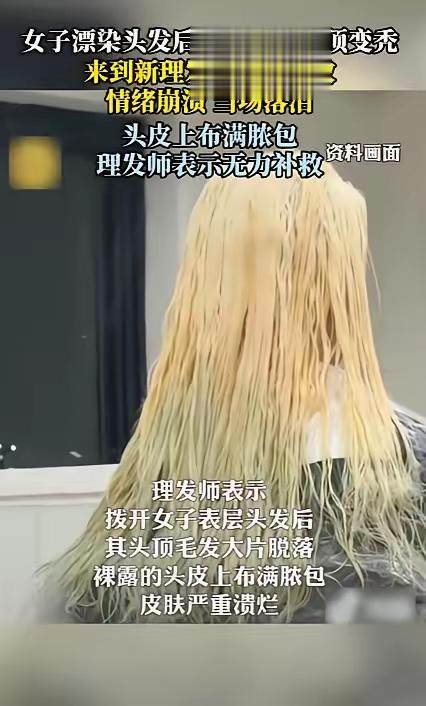 染头发染到头皮溃烂流脓，这为了美是无知还是单纯好面子？上海染发姑娘，理发师掀开