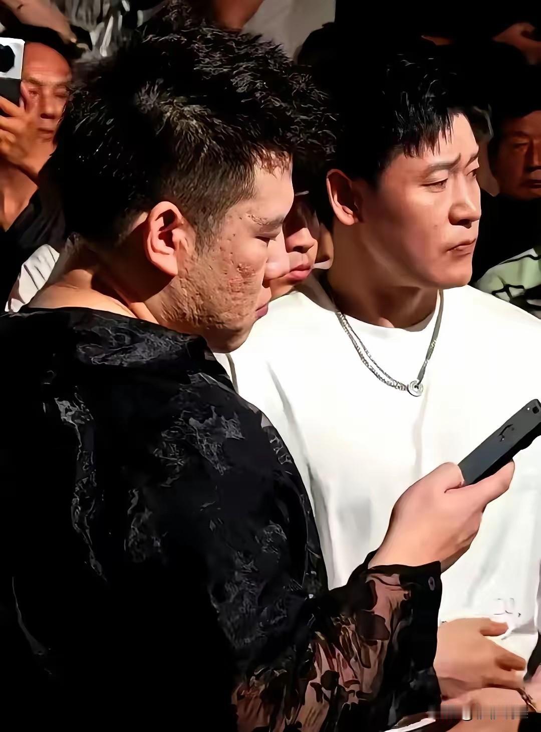 据说这是木森真实的脸？到底是相机拍摄的问题？还是他本人的脸就是这样？经常玩抖