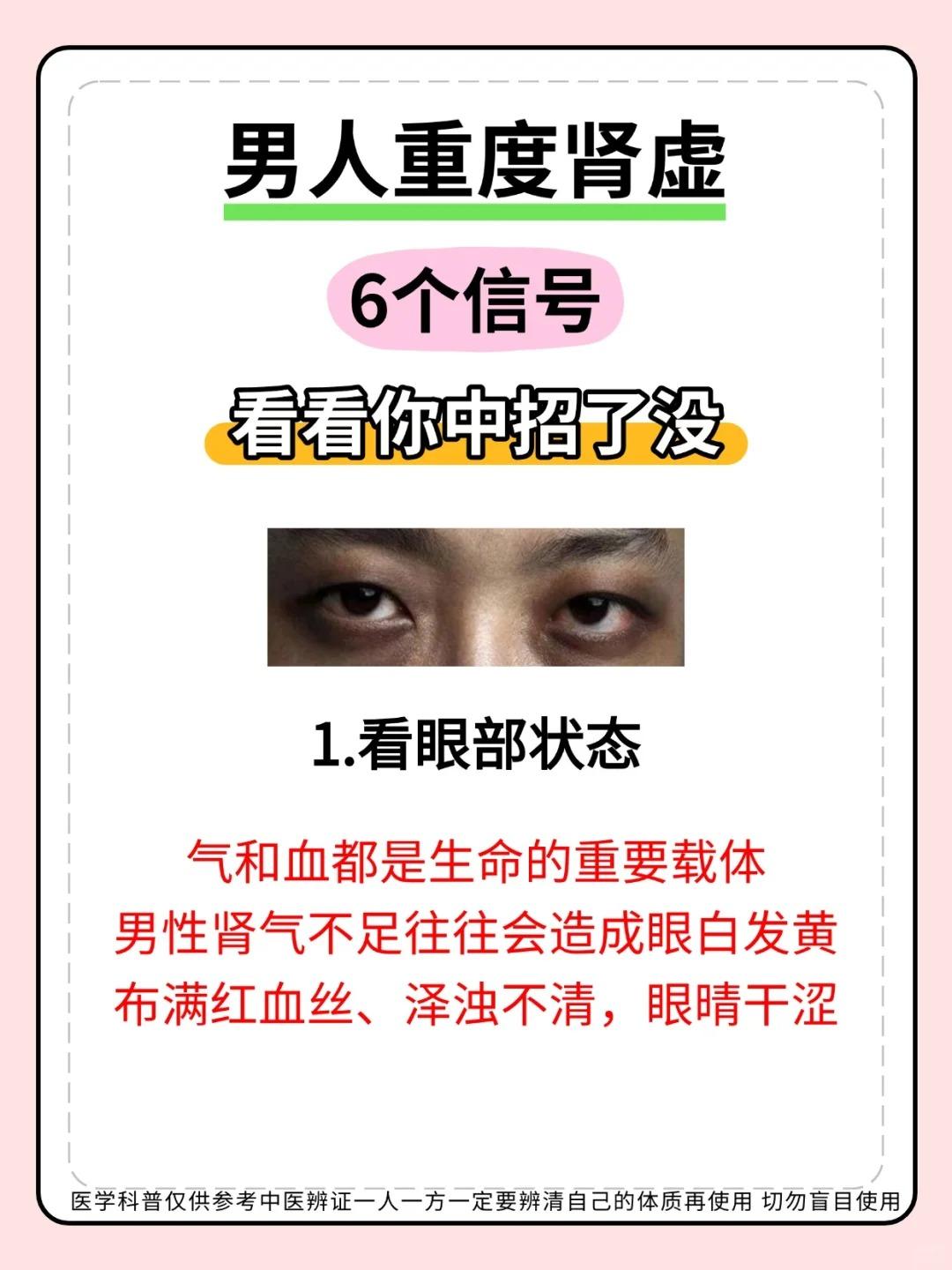 男朋友的肾虚不虚，看这6点就知道！