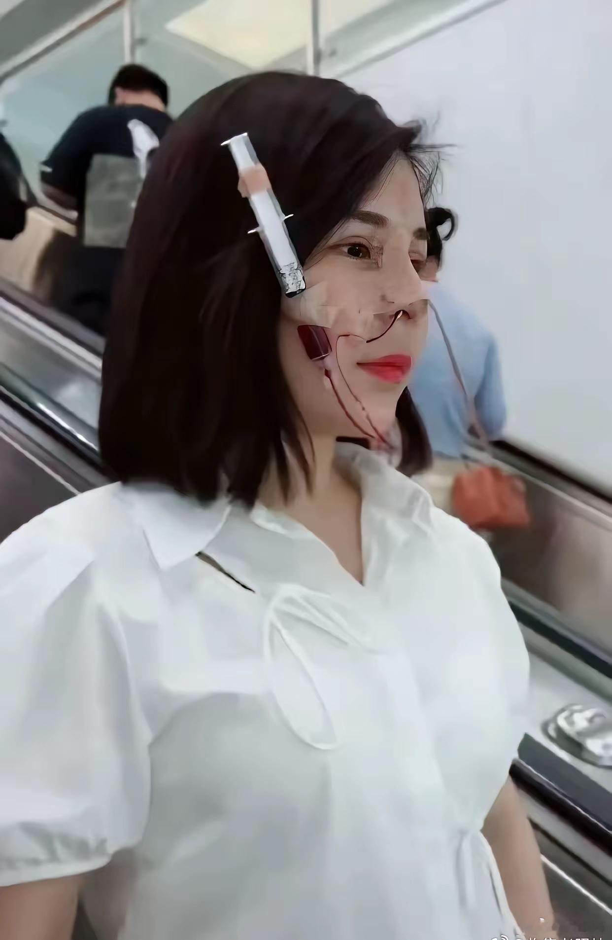 地铁偶遇一女生，着实吓了我一跳。见她脸颊贴着一支内含血水的医美针管，周遭乘客见状