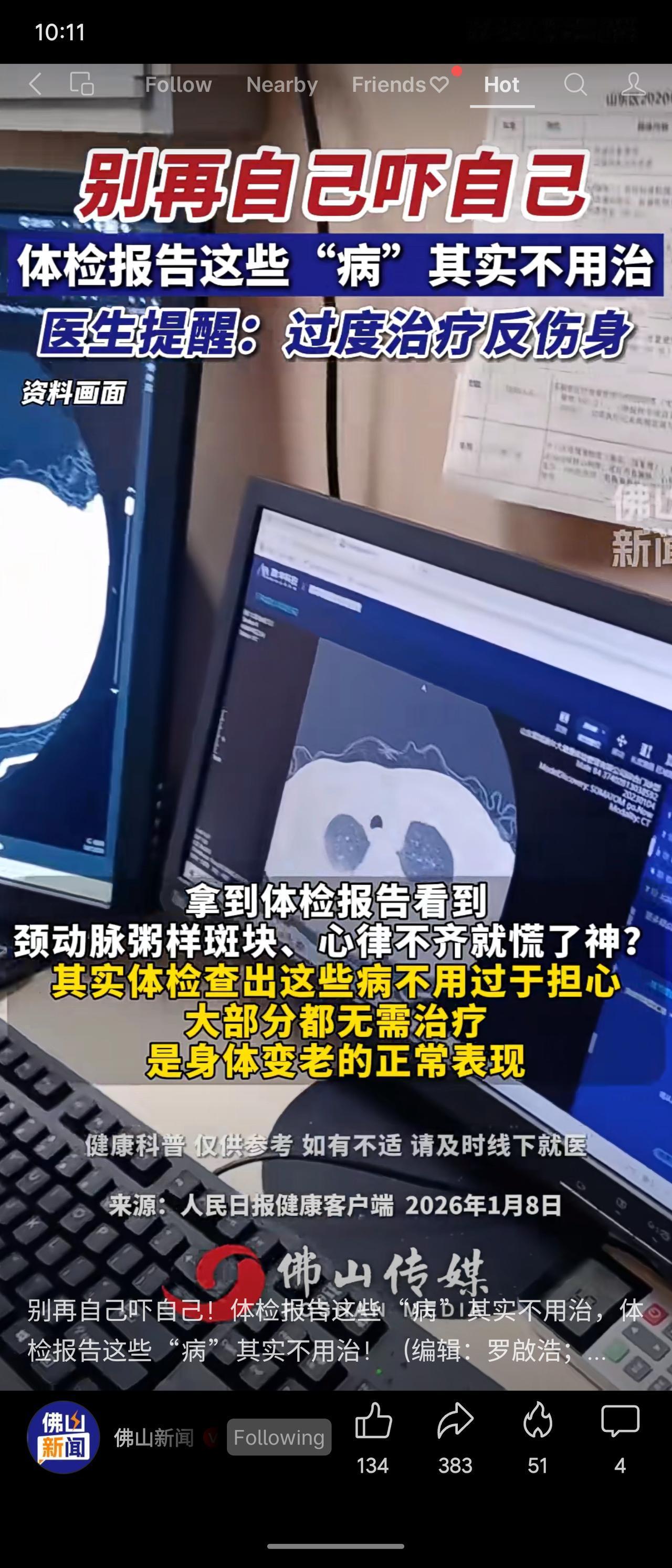 根据《人民日报》健康科普，体检报告中的多项“异常”实为正常老化表现，无需过度治疗