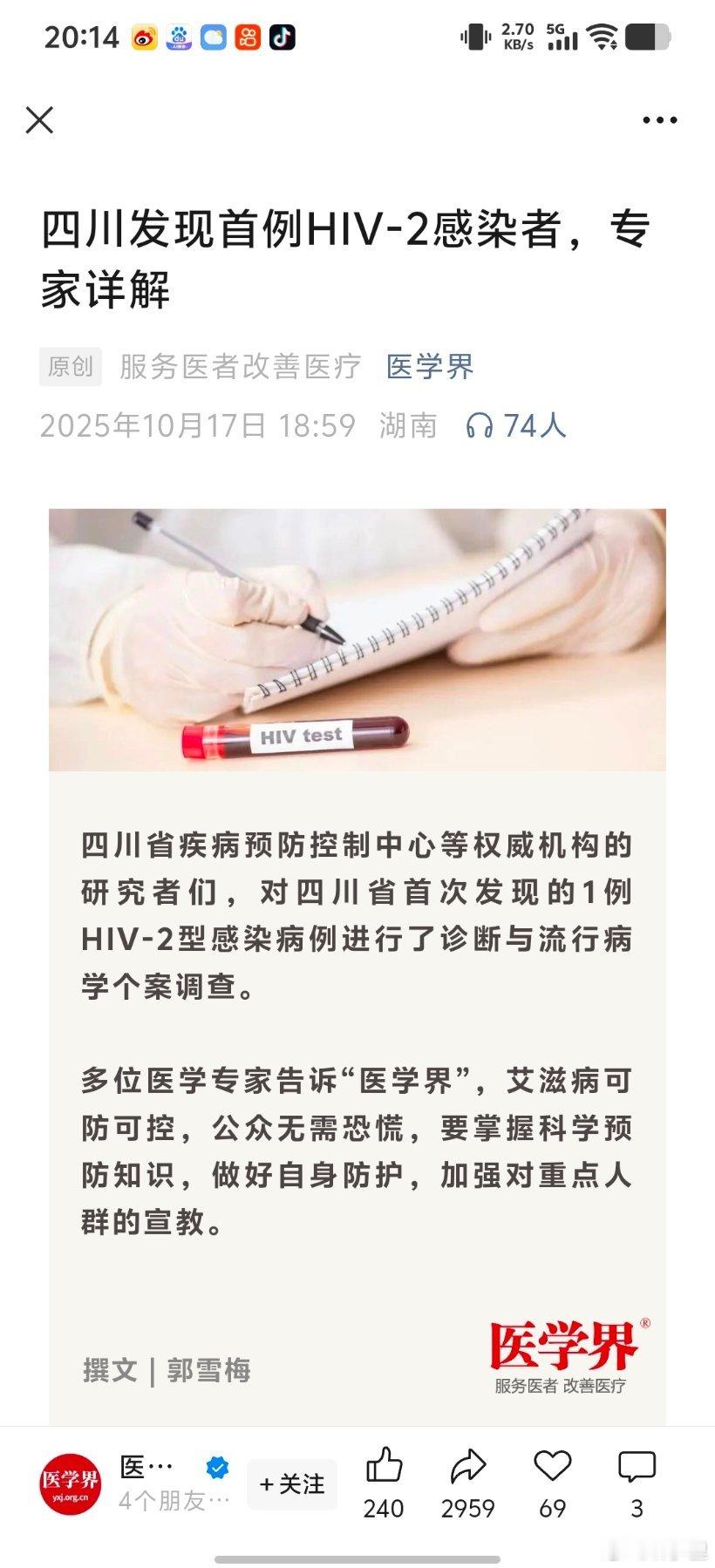 四川发现首例HIV-2感染者。艾滋病毒，分为HIV-1和HIV-2两种类型。平时