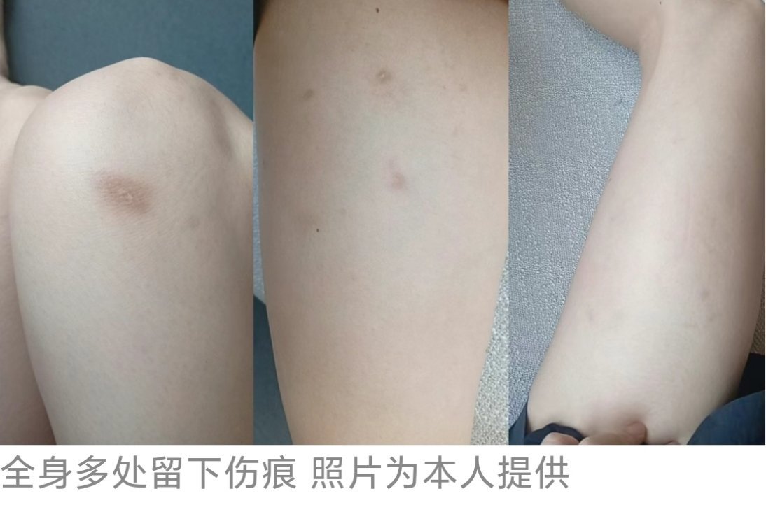 女子自述在柬埔寨遭遇绑架转卖折磨惨痛经历一名女子向西港日记讲述自己在柬埔寨遭遇绑