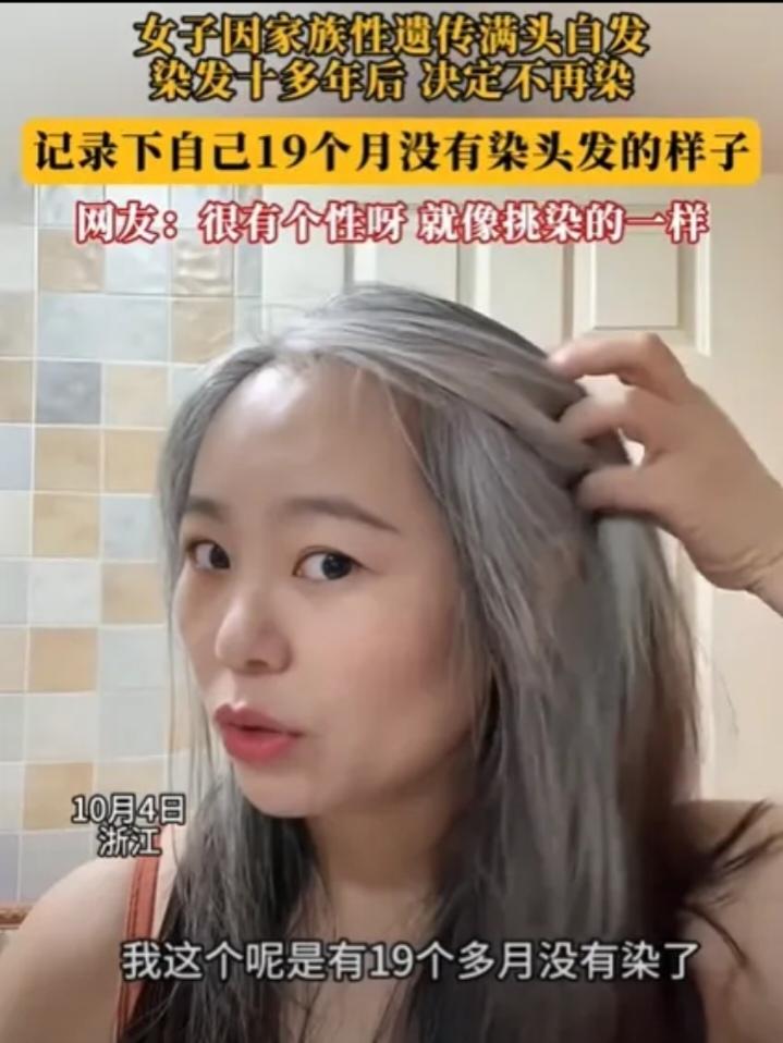 浙江一女子发现几根白发，她本以为拔了就是!万万没想到，仅仅几个月时间，她原本光亮