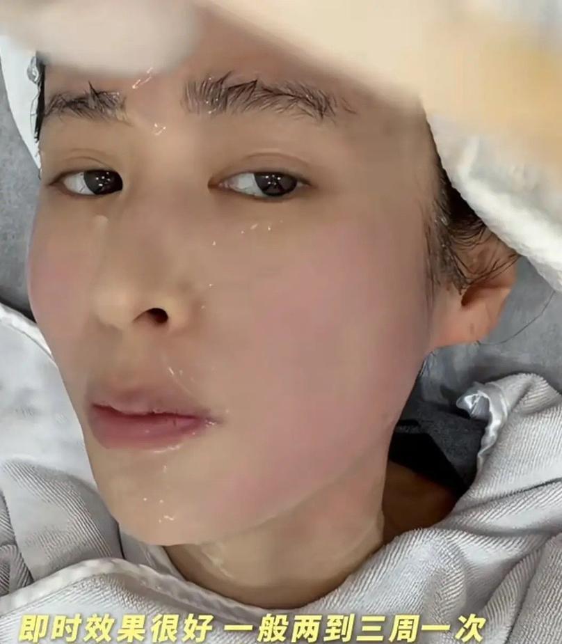 【颖儿10万“换脸”，暴露娱乐圈抗衰赛道的血腥内卷！】这根本不是美容，这是一