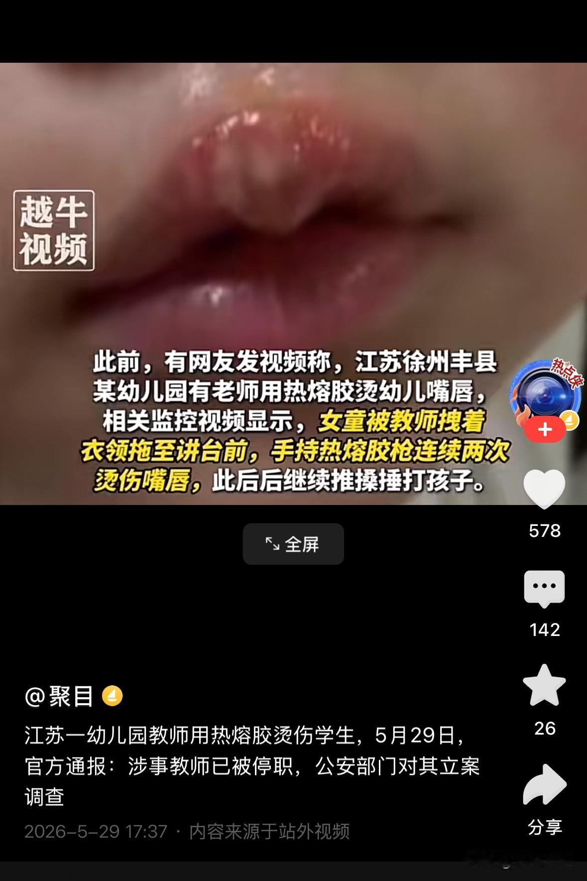 敢拿热熔胶烫嘴，绝不可能是第一次，还有没有更狠的。应该调取她入职幼儿园后的所