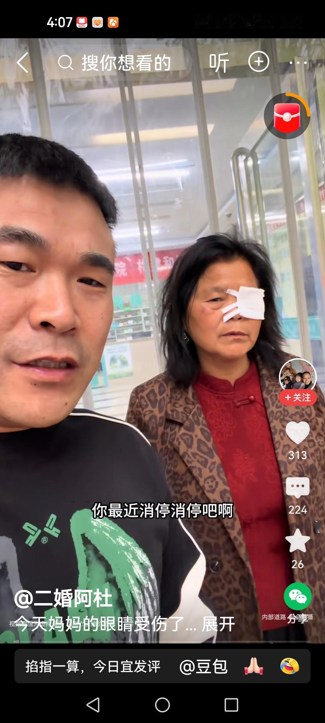 阿杜妈秒变“独眼龙”李佳生活十分精彩像演戏生活是一团麻，也有哪解不开的小疙瘩