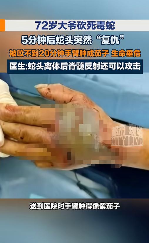 “这都还能咬人？”7月29日报道，浙江，一位72岁的大爷在钓鱼时，偶遇了一条眼镜