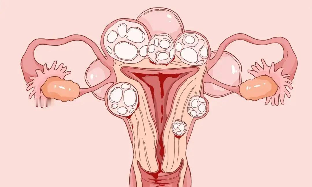 孕中期洗澡掉出鸡蛋大血块，姑娘当场吓哭以为娃要没，老公连夜扛去医院。B超一看娃