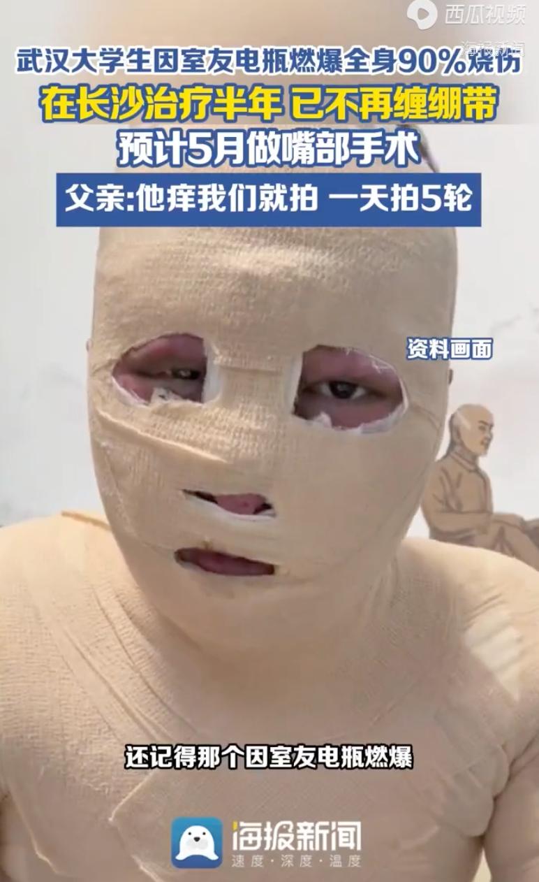 令人痛心！武汉，一名大三男生在出租屋睡觉，室友违规把电瓶车电池带进屋充电突然爆燃