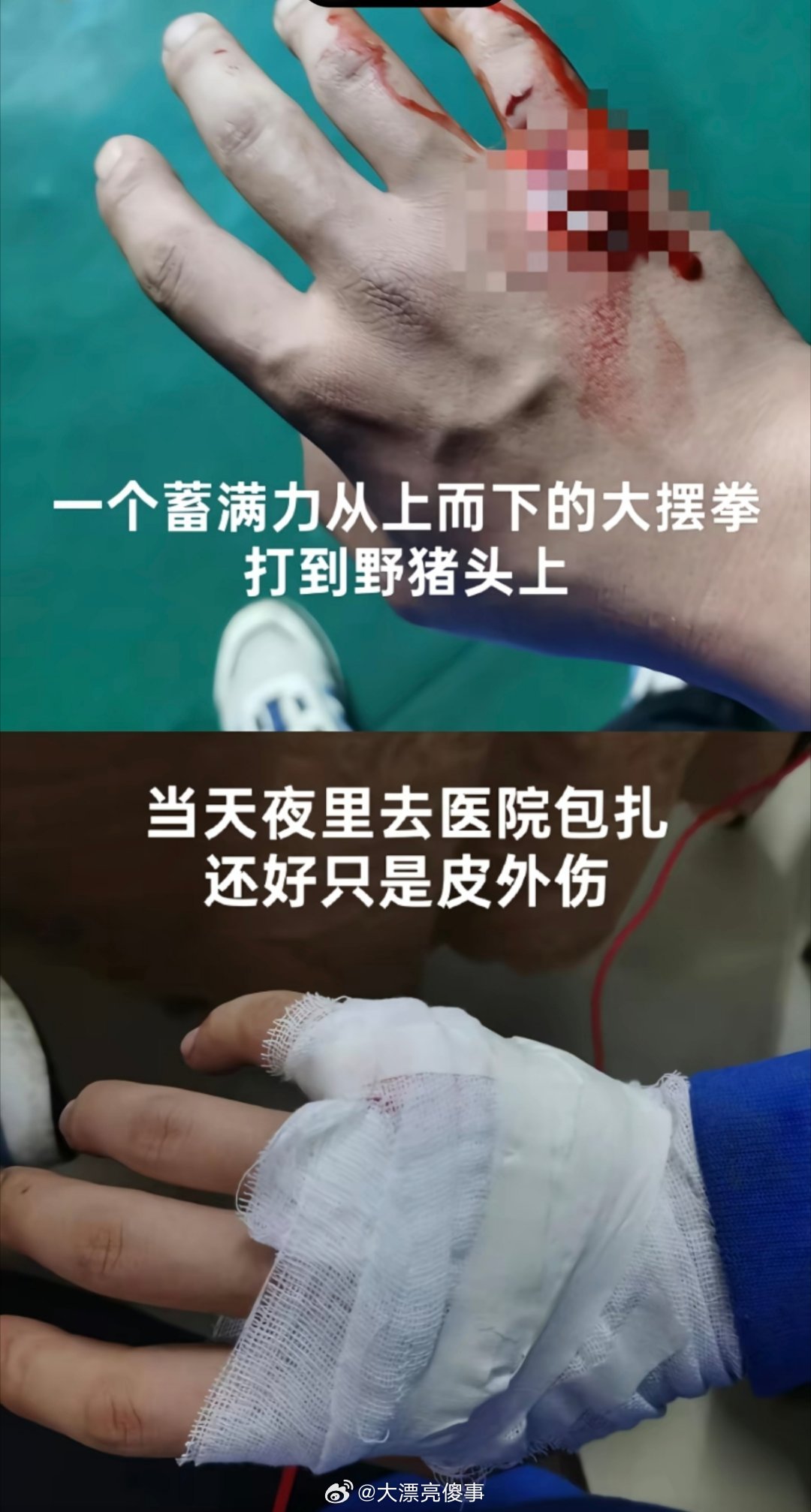 在抖音上你甚至可以看到，有人半夜爬山的时候一拳打死了一只野猪。