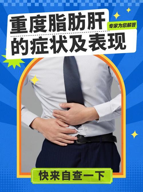 我发现出现这6个迹象，脂肪肝已经到重度了我在基层工作二十多