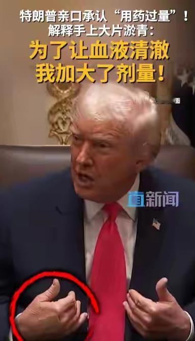 特朗普身体出状况了，健康堪忧，不知是否可以撑到1月20号？近来，79岁的特朗