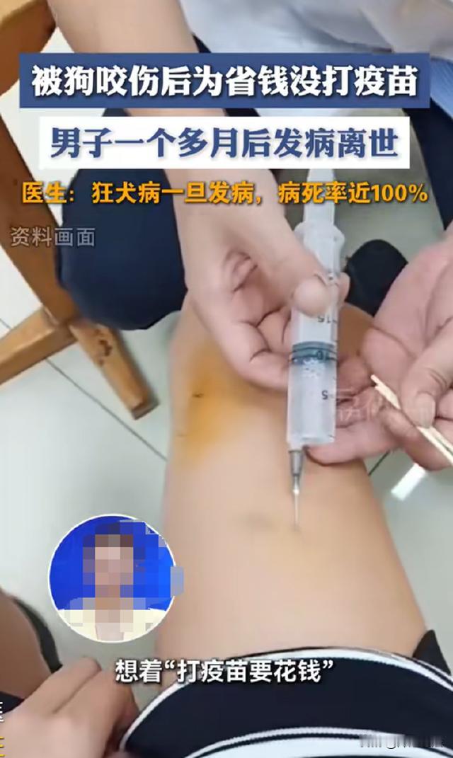 为省几百块丢了一条命！湖南浏阳，一男子被狗咬伤后，舍不得花几百块钱去打疫苗，瞒着