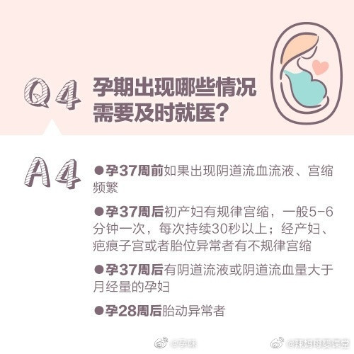 分娩那些事儿