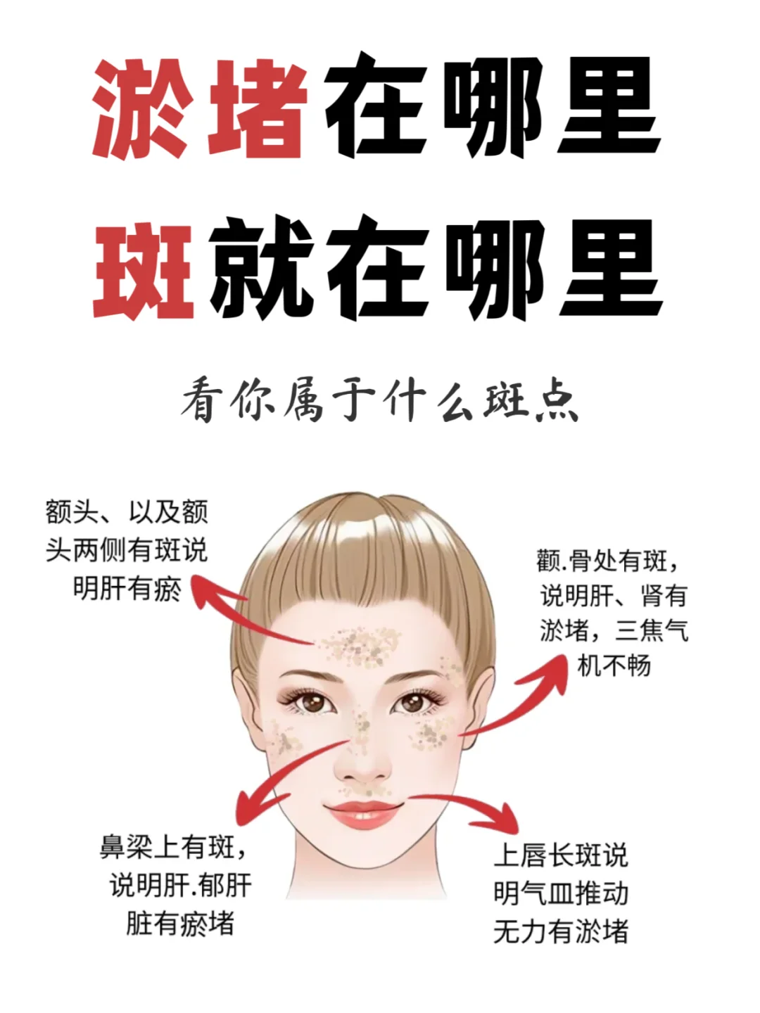 脸上有斑❓试试这样艾灸‼️