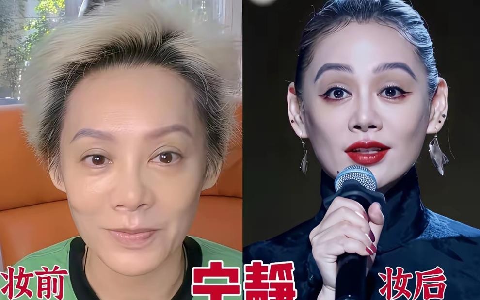 戚薇秦岚景甜先后把医美翻车这件事摊开讲，女明星的冻龄神话先碎了一层。戚薇直播里眉尾抬不起来，笑的时候