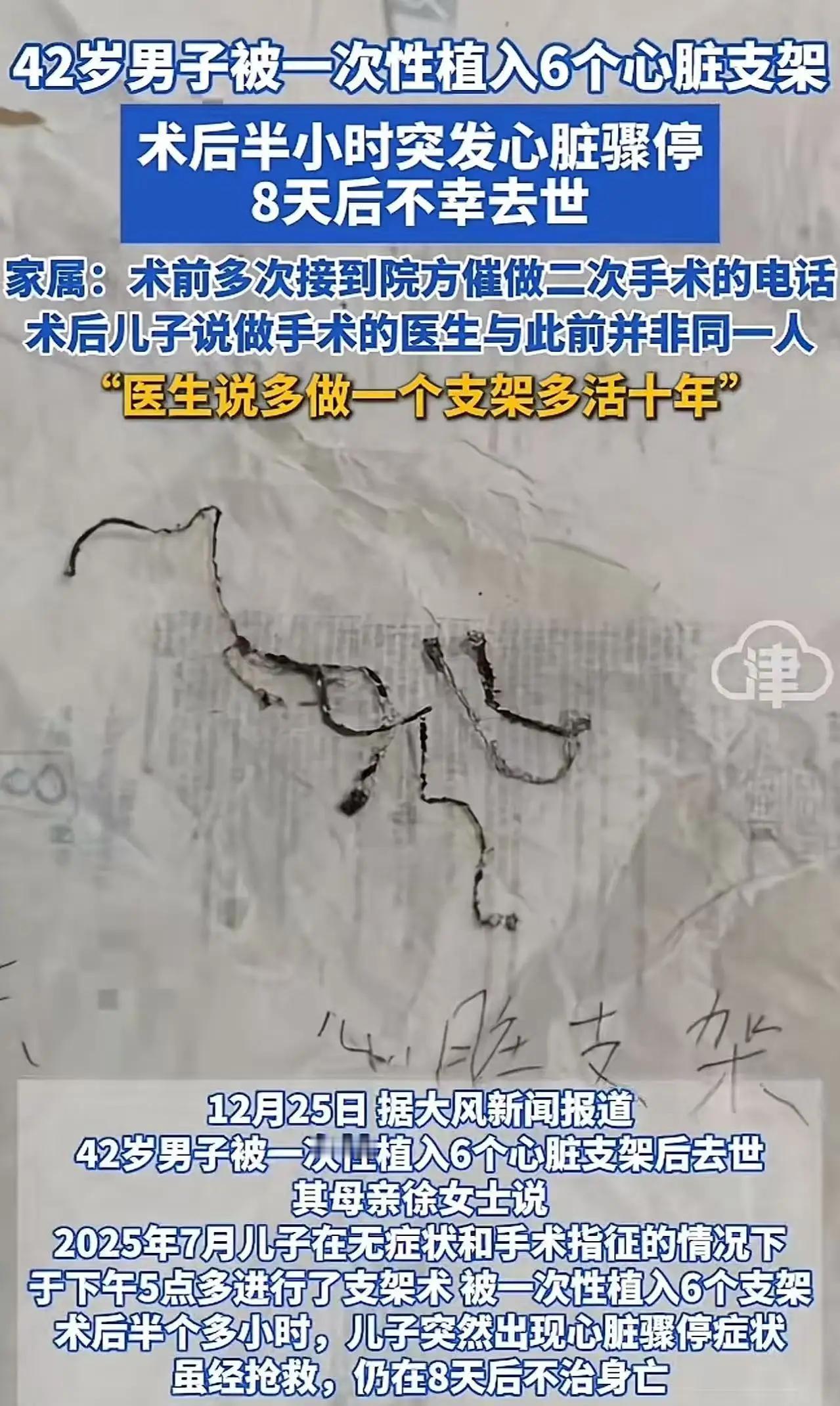 支架悲剧背后：当医疗决策被利益阴影笼罩，我们还能相信谁？“多做几个支架，能多