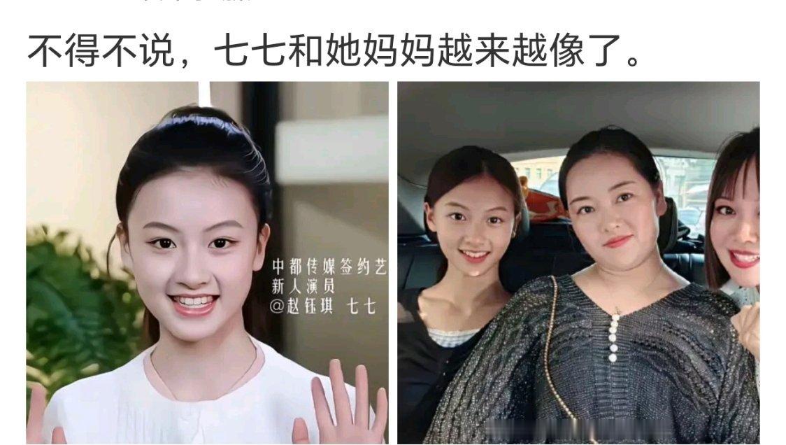 我感觉她后面的脸型走向，可能跟她妈一样