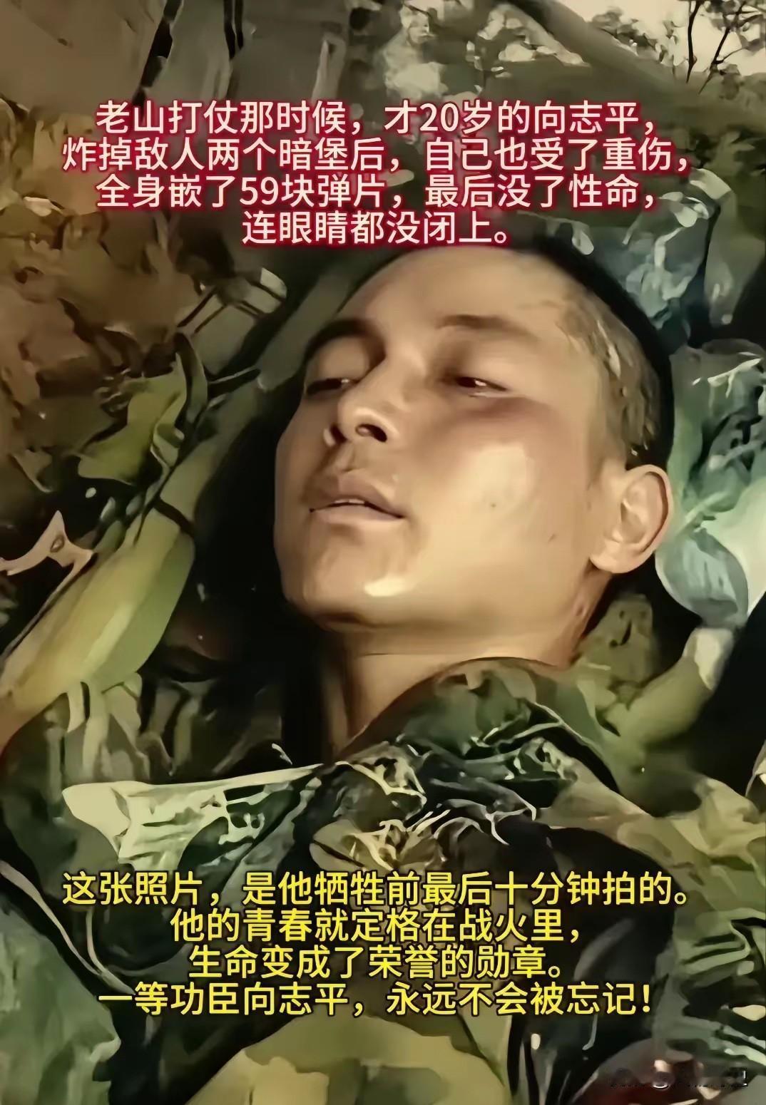 20岁的向志平，在老山战役的硝烟里炸掉敌人两个暗堡后，身中59块弹片受了致命重伤