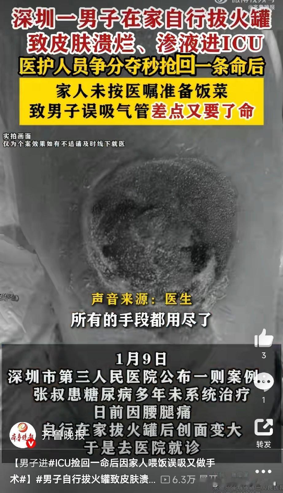 这爱太沉重了深圳有位张叔，糖尿病好多年了，自己没当回事，也没好好治。这不，