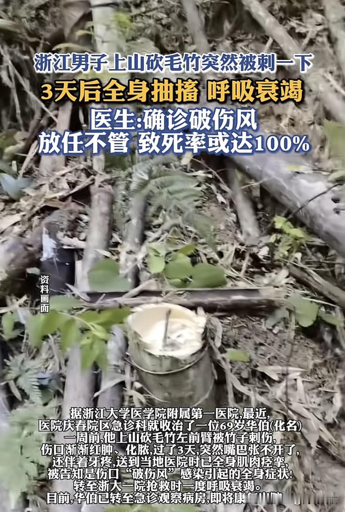 “真吓人啊！”9月30日报道，浙江，一男子上山砍毛竹，手臂不小心被竹子刺伤，刚开