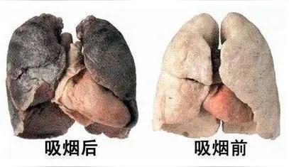 扎心真相！权威研究证实：吸烟者平均寿命短10年很多老烟民总抱着侥幸心理，觉